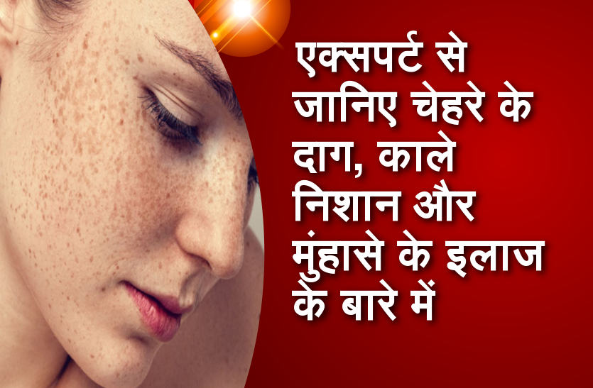 एक्सपर्ट से जानिए चेहरे के दाग, काले निशान और मुंहासे के इलाज के बारे में