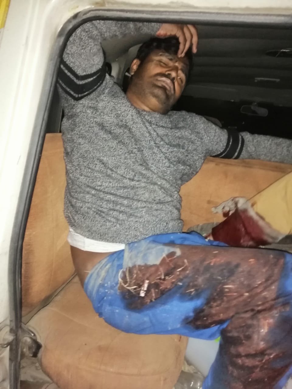 UP Police Encounter: पुलिस मुठभेड़ में दो गोकश घायल, एक सिपाही को लगी गोली